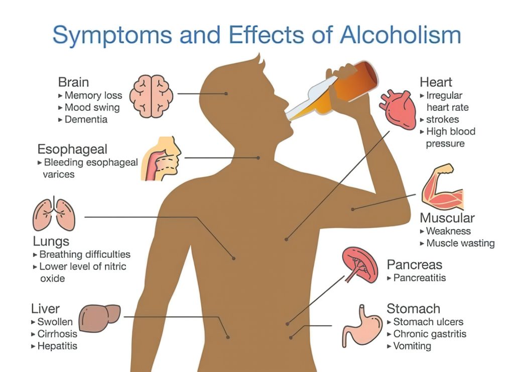 Efek Alkohol: Cara Efektif Menetralisir dan Mengatasinya